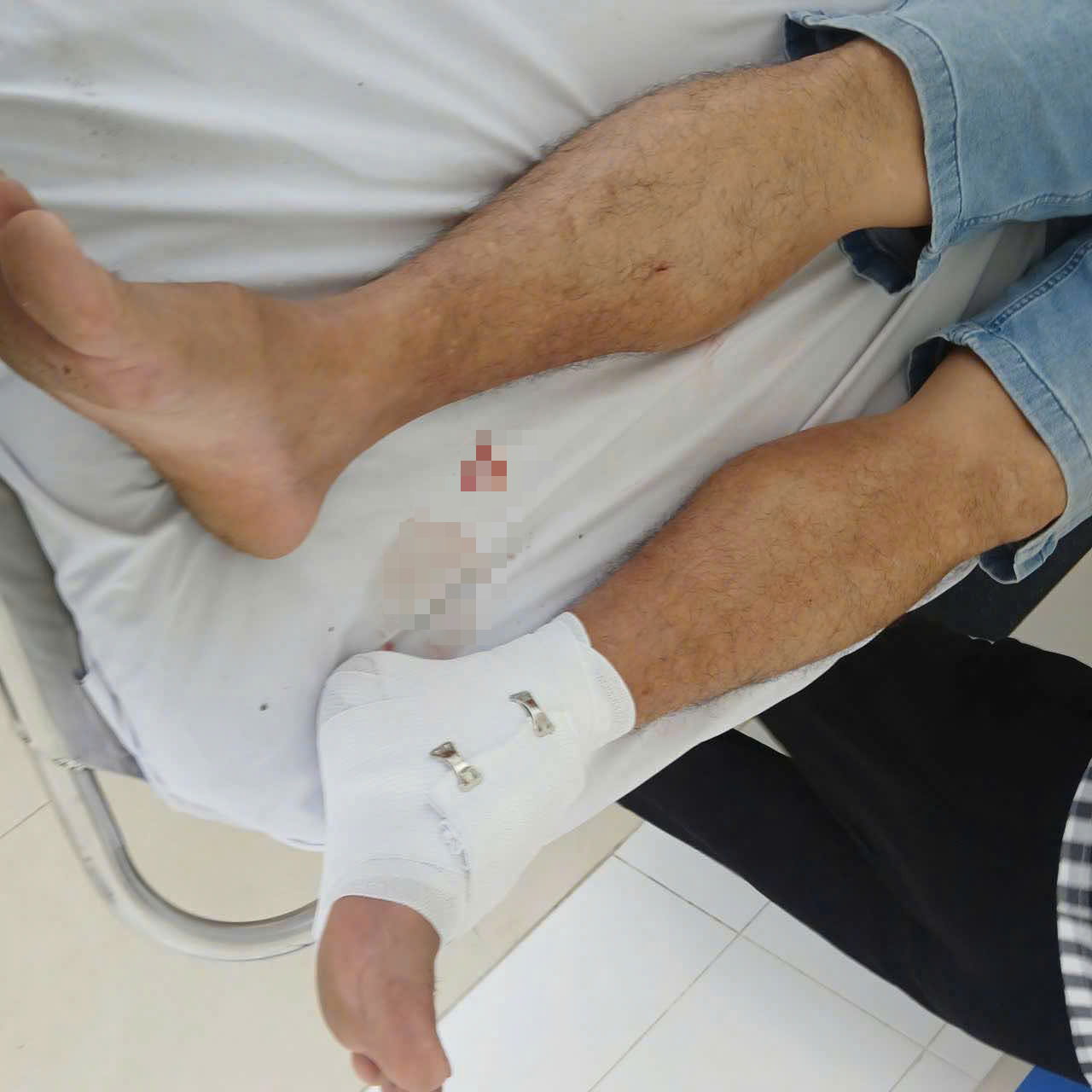 Vụ cá sấu sổng chuồng cắn thầy giáo ở Tây Ninh: Lời khai bất ngờ từ người nuôi - Ảnh 2. Vụ cá sấu sổng chuồng cắn thầy giáo ở Tây Ninh: Bất ngờ lời khai của người nuôi - Ảnh 2.