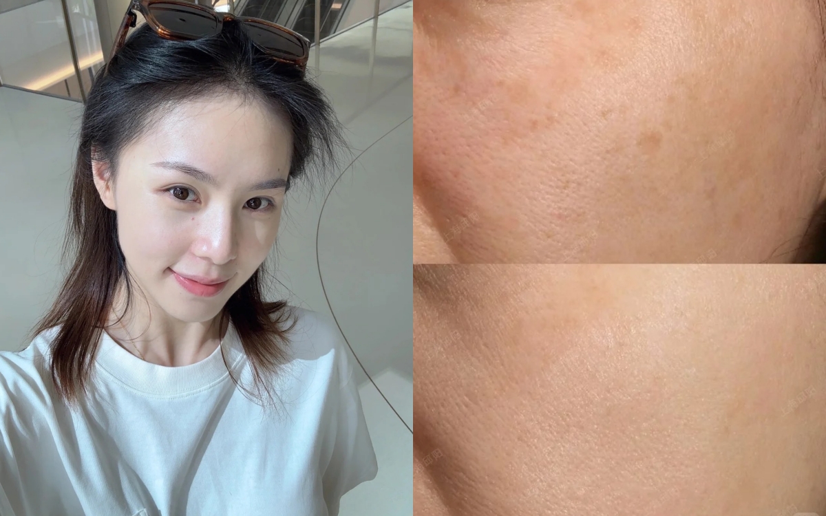 Sau 30, tôi chỉ tin 5 lọ serum này để da hết nám, sáng mịn như phát sáng - Ảnh 1. Sau 30, tôi chỉ tin 5 lọ serum này để da hết nám, sáng mịn như phát sáng - Ảnh 1.