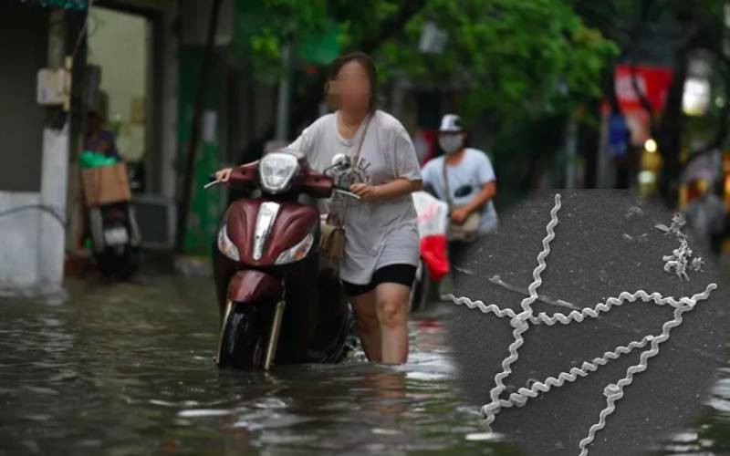 Cảnh Báo: Nguy cơ nhiễm xoắn khuẩn có thể gây suy gan thận và tử vong từ nước ngập