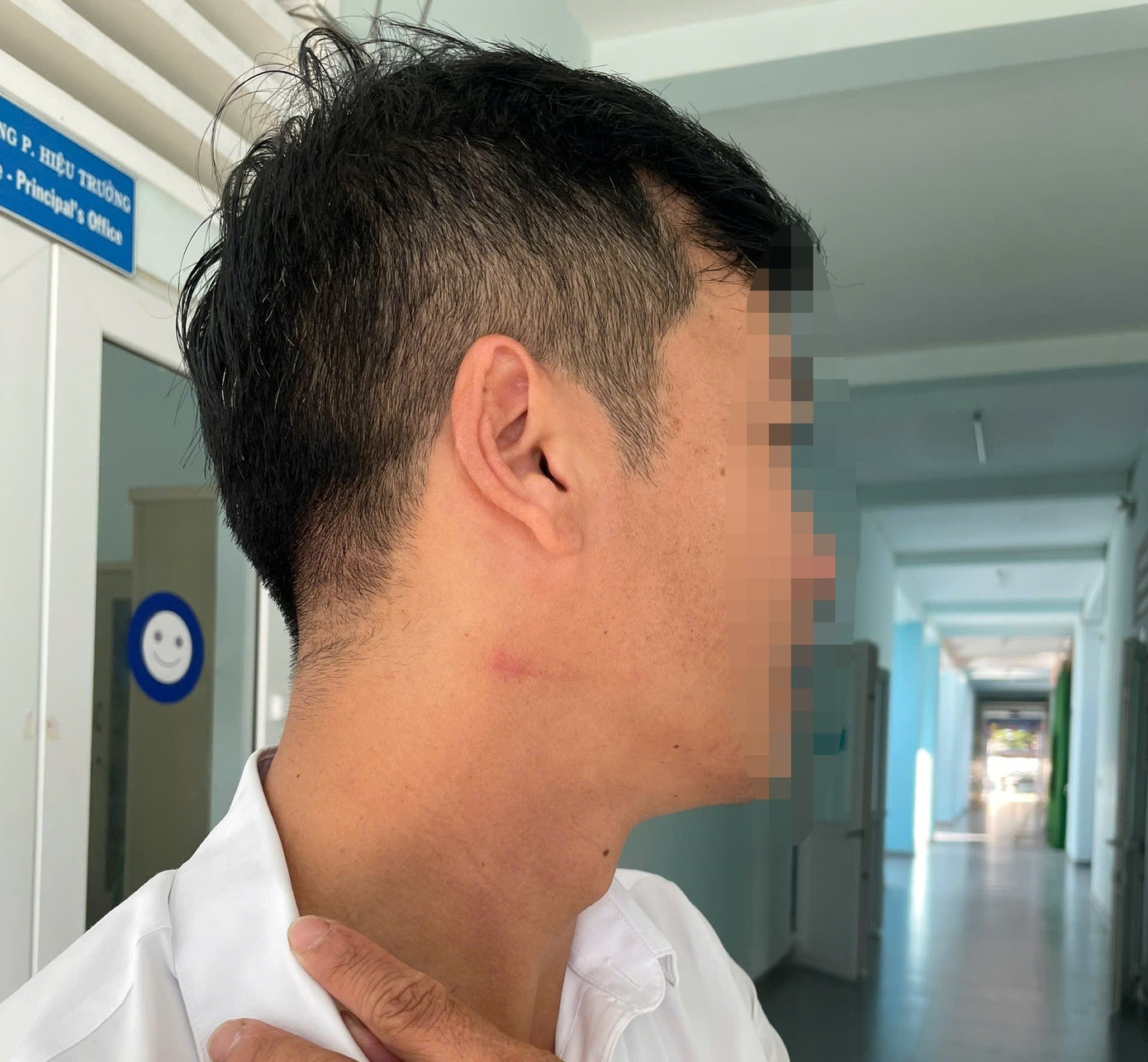 Thầy giáo bị đồng nghiệp bóp cổ giữa sân trường vì nhắc đỗ xe sai quy định - Ảnh 1.