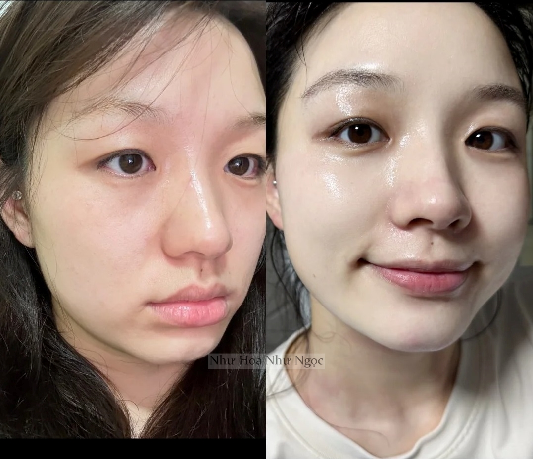 Ngoài 30 tuổi mà da vẫn bóng như gương nhờ 5 lọ "serum bơm nước" đỉnh cao - Ảnh 2. Ngoài 30 tuổi mà da vẫn bóng như gương nhờ 5 lọ "serum bơm nước" đỉnh cao - Ảnh 2.