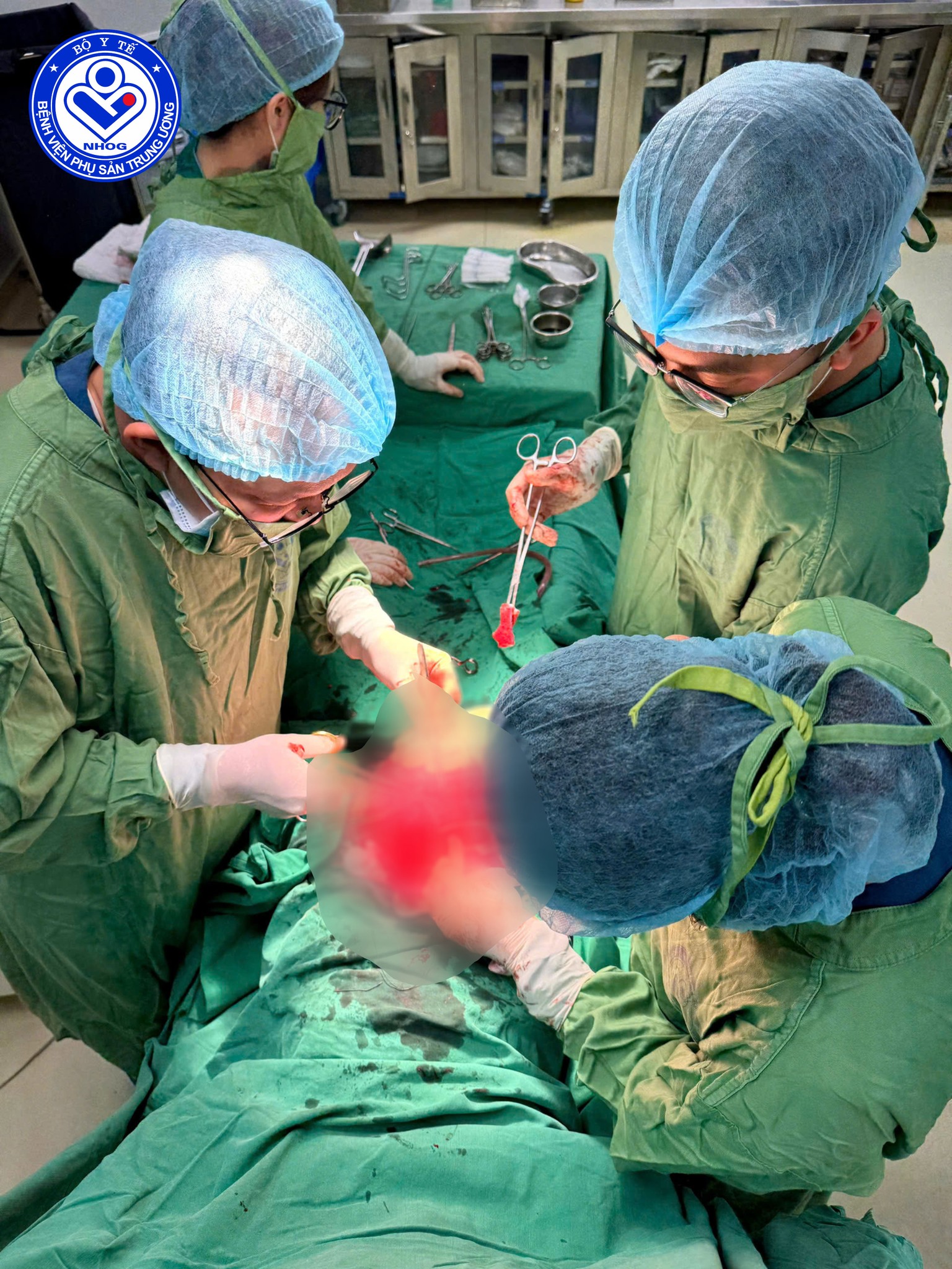 Cuộc đại phẫu đầy thử thách: Giành giật 2 sự sống từ lằn ranh sinh tử, mẹ sa dây rốn, vỡ ối hoàn toàn, u xơ tử cung khổng lồ- Ảnh 1. Cuộc đại phẫu đầy thử thách: Giành giật 2 sự sống từ lằn ranh sinh tử, mẹ sa dây rốn, vỡ ối hoàn toàn, u xơ tử cung khổng lồ- Ảnh 1.
