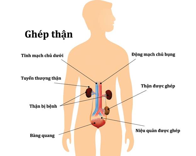 Người cha có phản ứng ngọt ngào khi biết người hiến thận cho mình là cô con gái 24 tuổi mà ông không nghĩ tới- Ảnh 4. Người cha có phản ứng ngọt ngào khi biết người hiến thận cho mình là cô con gái 24 tuổi mà ông không nghĩ tới- Ảnh 4.