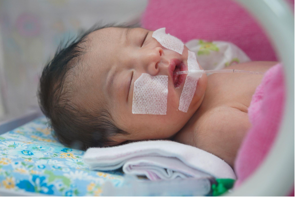 Giải mã thủ phạm RSV gây viêm tiểu phế quản ở trẻ nhỏ - Ảnh 2. Giải mã thủ phạm RSV gây viêm tiểu phế quản ở trẻ nhỏ - Ảnh 2.