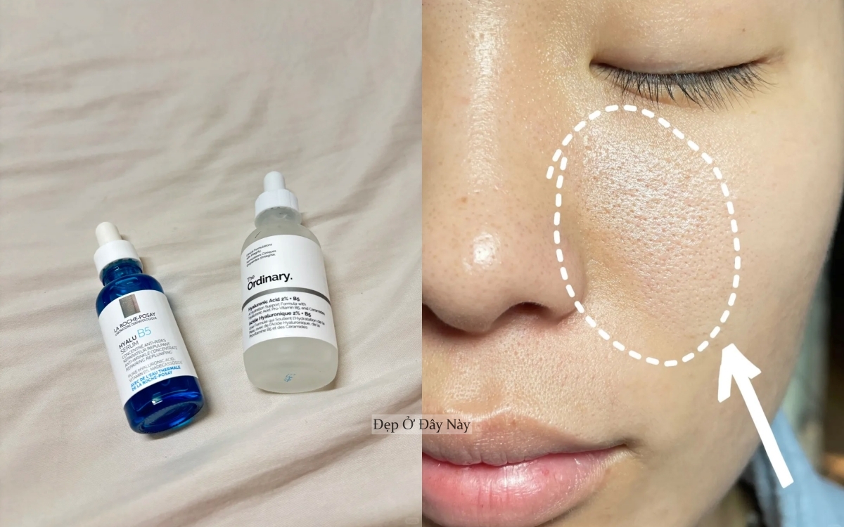 Nhờ AI, nàng blogger 27 tuổi tìm được chân ái trị da mụn, lỗ chân lông to - Ảnh 2.