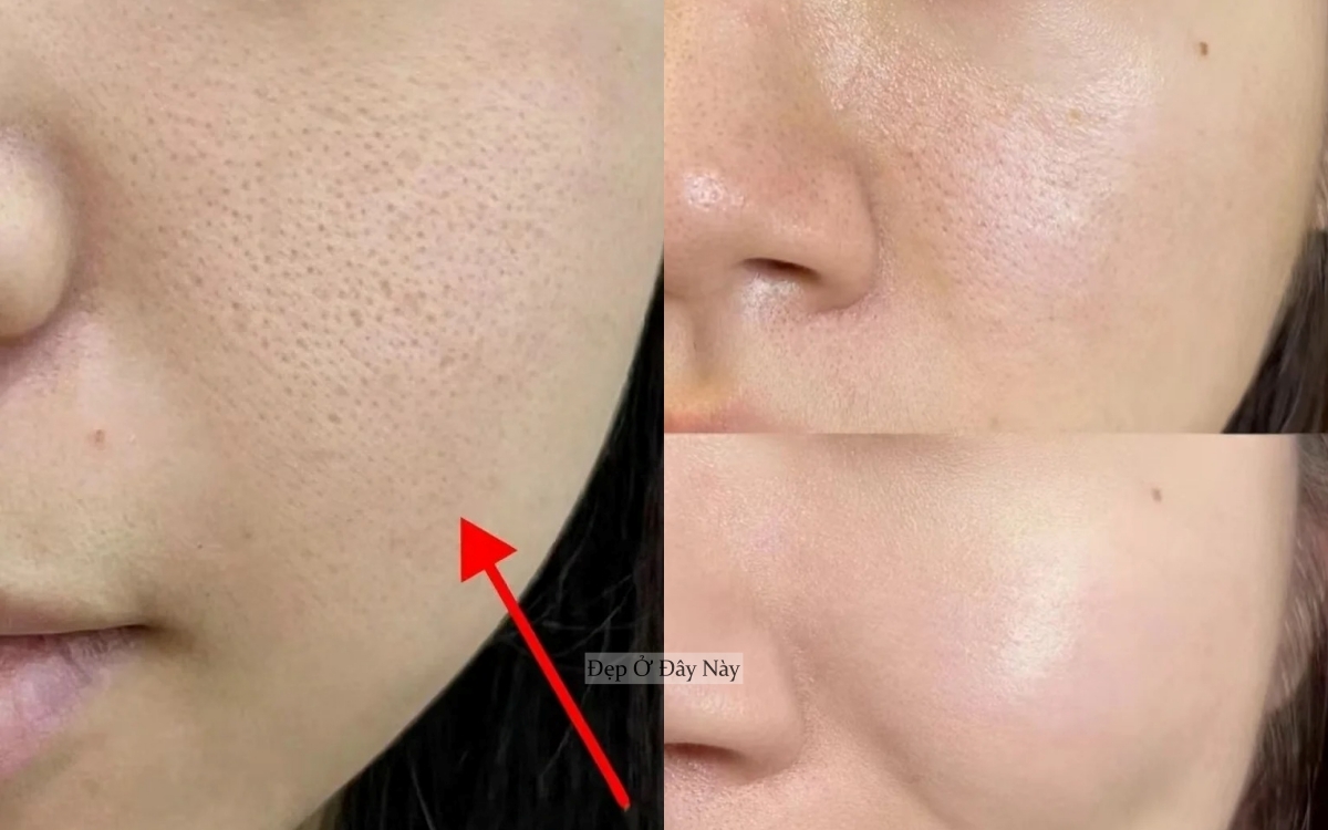 Nhờ AI, nàng blogger 27 tuổi tìm được chân ái trị da mụn, lỗ chân lông to - Ảnh 7.