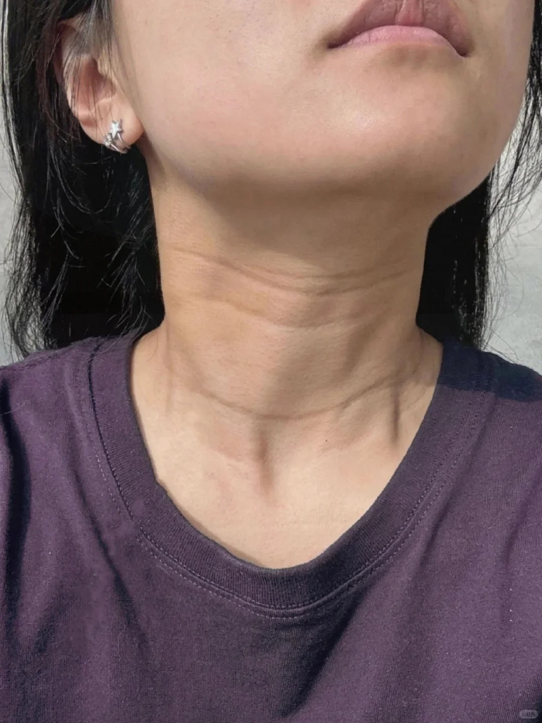 5 vùng da lão hóa nhanh nhất mà 90% chị em đều bỏ quên khi skincare - Ảnh 4. 5 vùng da lão hóa nhanh nhất mà 90% chị em đều bỏ quên khi skincare - Ảnh 4.