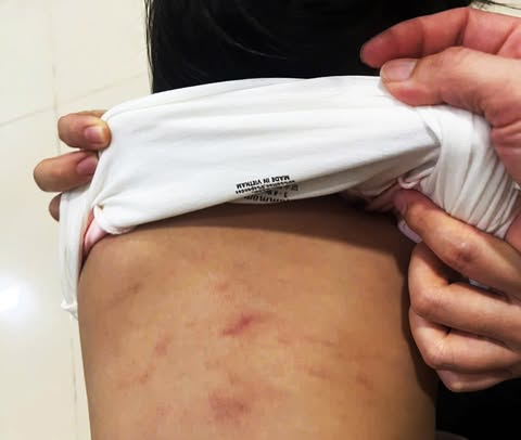 Vụ bé gái 2 tuổi ở Cà Mau bị bạo hành: Tinh thần hoảng loạn - Ảnh 1.