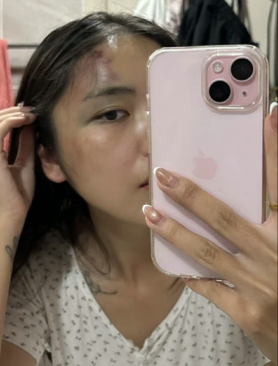 Hà Nội: Chồng đánh vợ thủng màng nhĩ, chấn động não ngay trước mắt hàng xóm - Ảnh 2.