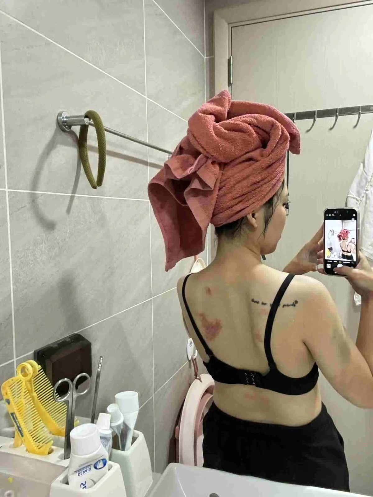 Hà Nội: Chồng đánh vợ thủng màng nhĩ, chấn động não ngay trước mắt hàng xóm - Ảnh 3.