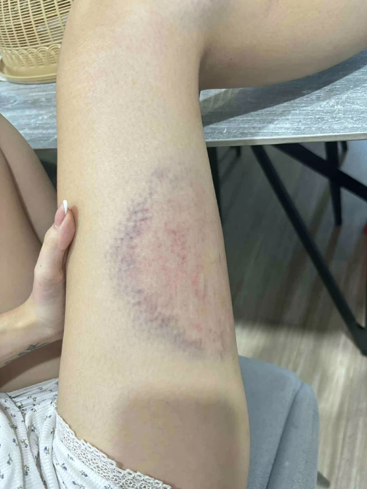 Hà Nội: Chồng đánh vợ thủng màng nhĩ, chấn động não ngay trước mắt hàng xóm - Ảnh 4.