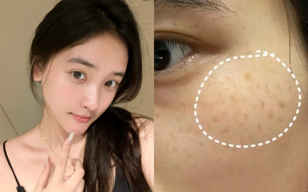 Không cần mỹ phẩm ngoại, đây là 5 kem dưỡng