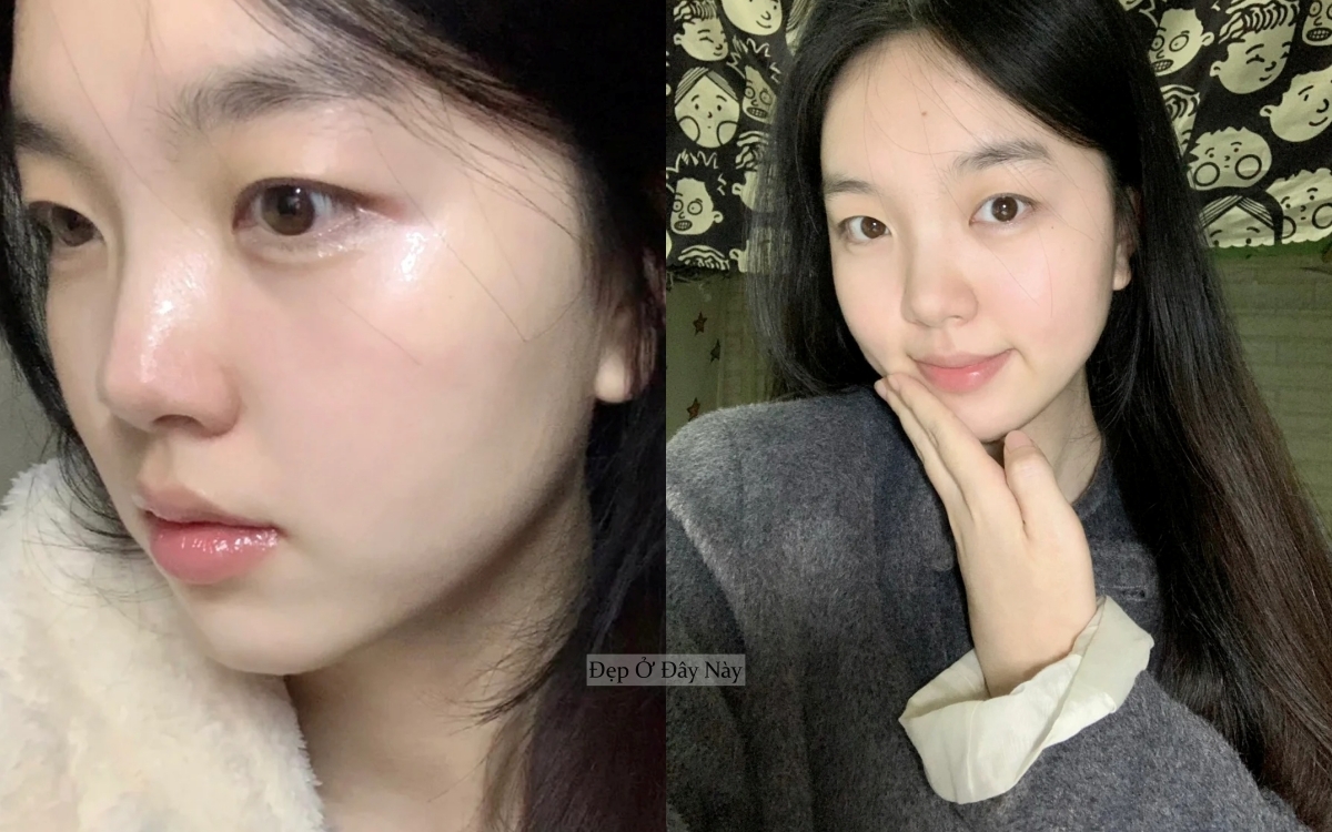 Cô nàng da khô tìm ra 3 serum cấp nước “thần thánh” giúp da ngậm nước 24h - Ảnh 5.