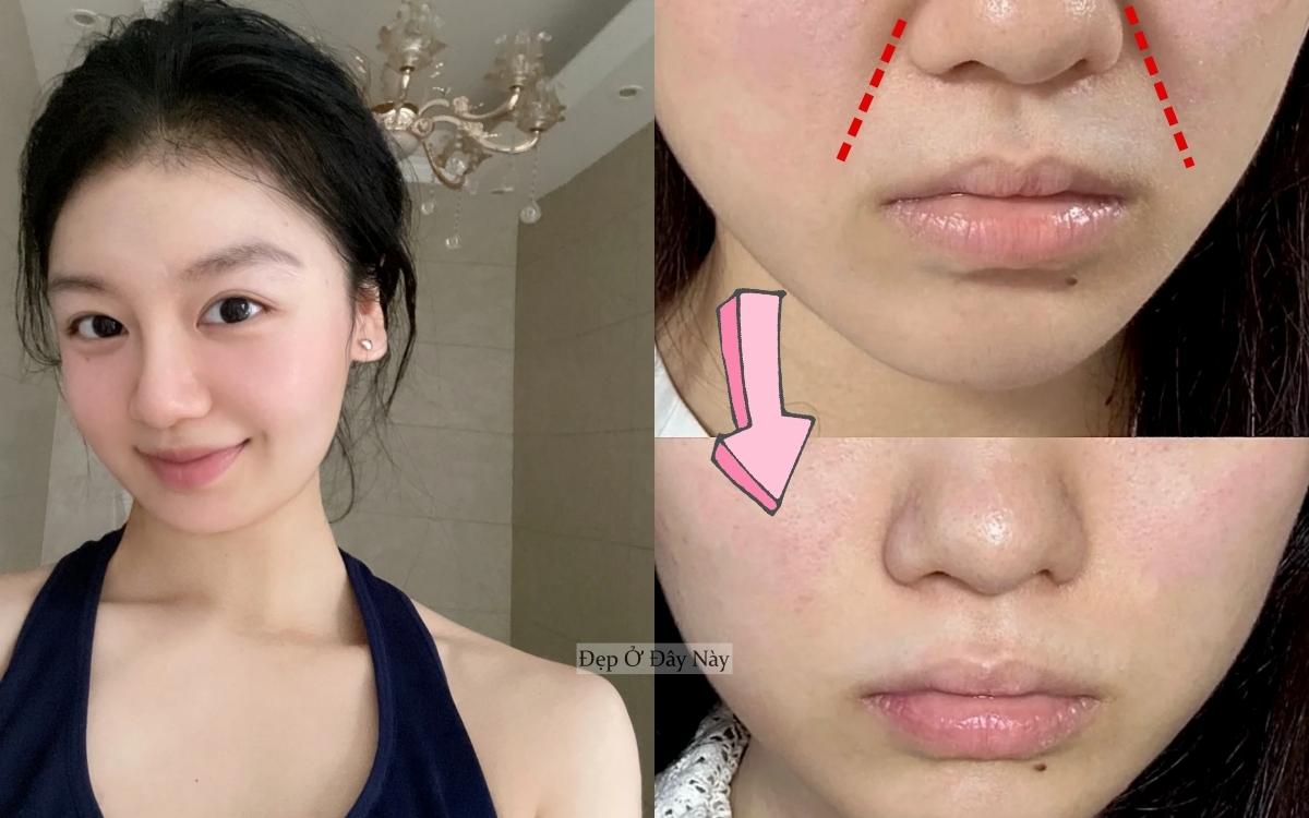 Trẻ hơn 5 tuổi nhờ những mẹo cải thiện rãnh cười đơn giản tại nhà - Ảnh 1.