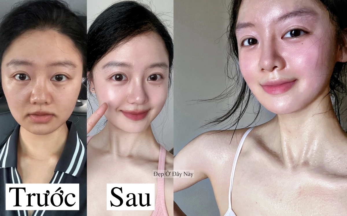 Trẻ hơn 5 tuổi nhờ những mẹo cải thiện rãnh cười đơn giản tại nhà - Ảnh 2.