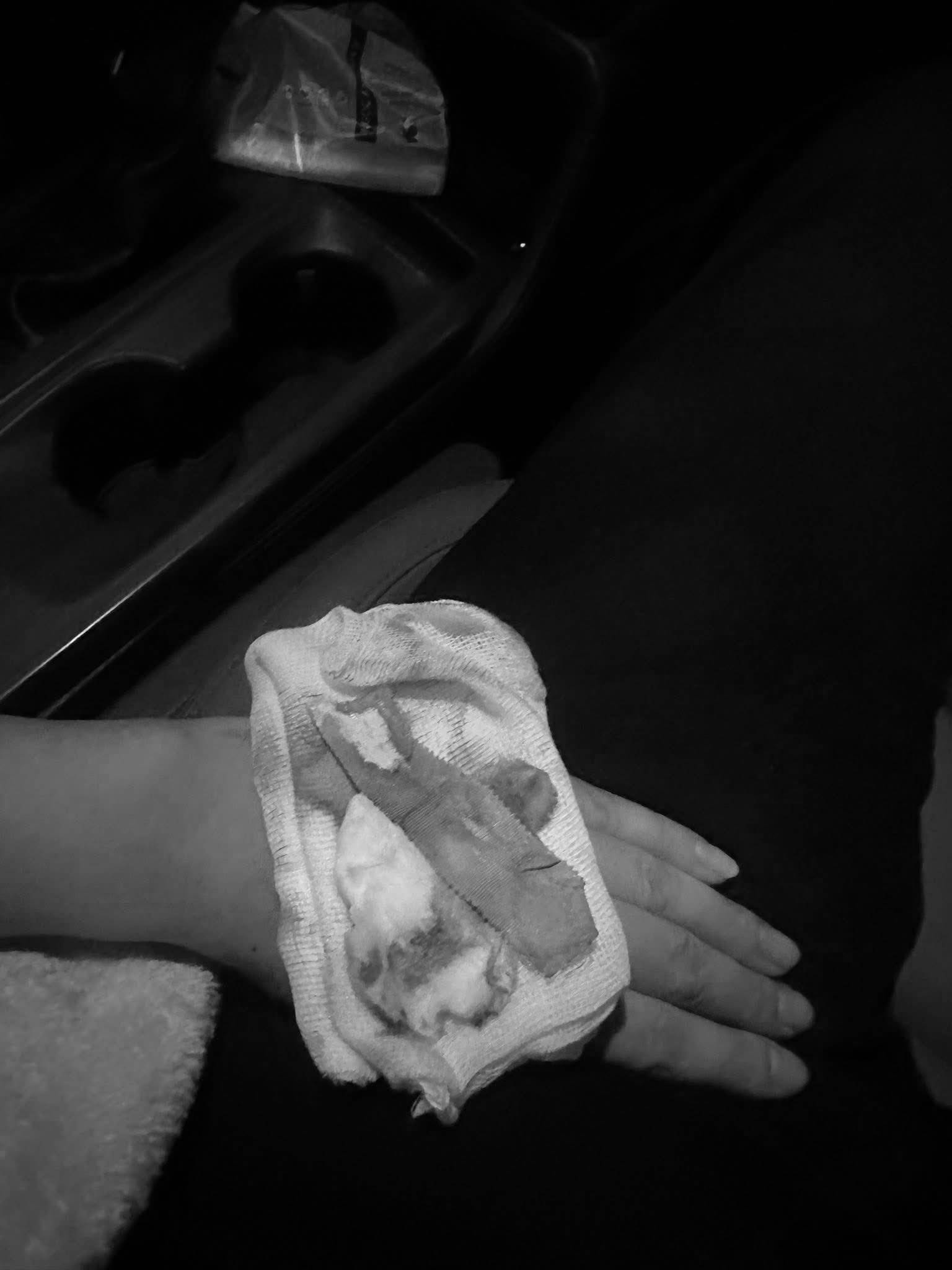 Người phụ nữ mắc cúm A chỉ sốt khoảng 30 phút là mất kiểm soát, co giật, mắt sưng không mở được- Ảnh 2. Người phụ nữ mắc cúm A chỉ sốt khoảng 30 phút là mất kiểm soát, co giật, mắt sưng không mở được- Ảnh 2.