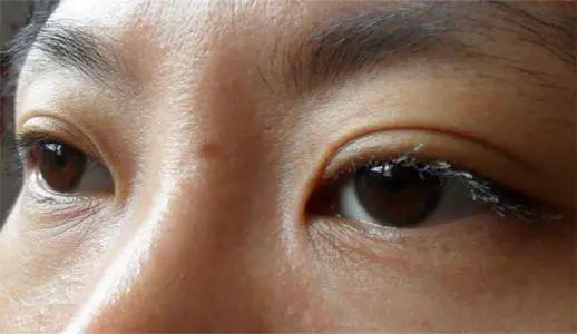 Chỉ cần nhìn vào mặt có thể biết thận của bạn khỏe đến mức nào: Phương pháp cực kỳ đơn giản để nuôi dưỡng và tăng cường thận hiệu quả - Ảnh 1.