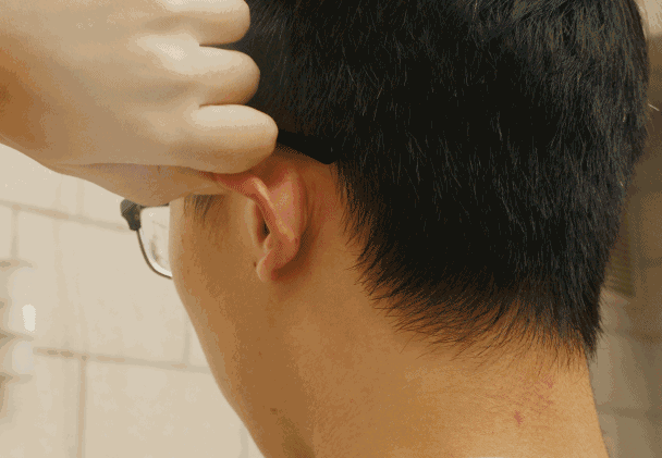 Chỉ cần nhìn vào mặt có thể biết thận của bạn khỏe đến mức nào: Phương pháp cực kỳ đơn giản để nuôi dưỡng và tăng cường thận hiệu quả - Ảnh 3.