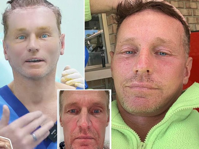 Người đàn ông Úc không chụp ảnh suốt 20 năm bỗng nổi tiếng sau khi đến Việt Nam phẫu thuật thẩm mỹ, điện thoại Iphone cũng không nhận diện được - Ảnh 4.