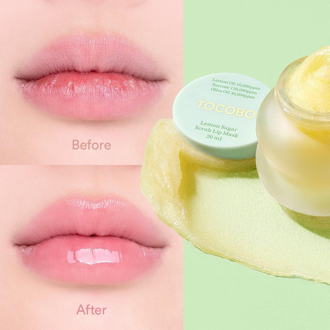 Chuyên viên thẩm mỹ viện 10 năm mách mẹo trị môi khô tại nhà, rẻ mà hiệu quả bất ngờ - Ảnh 6.