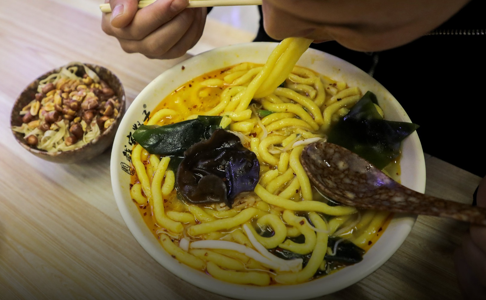 Người phụ nữ 40 tuổi suy gan và suy thận nguy kịch chỉ vì 1 bát mì, bác sĩ hoảng hốt: 