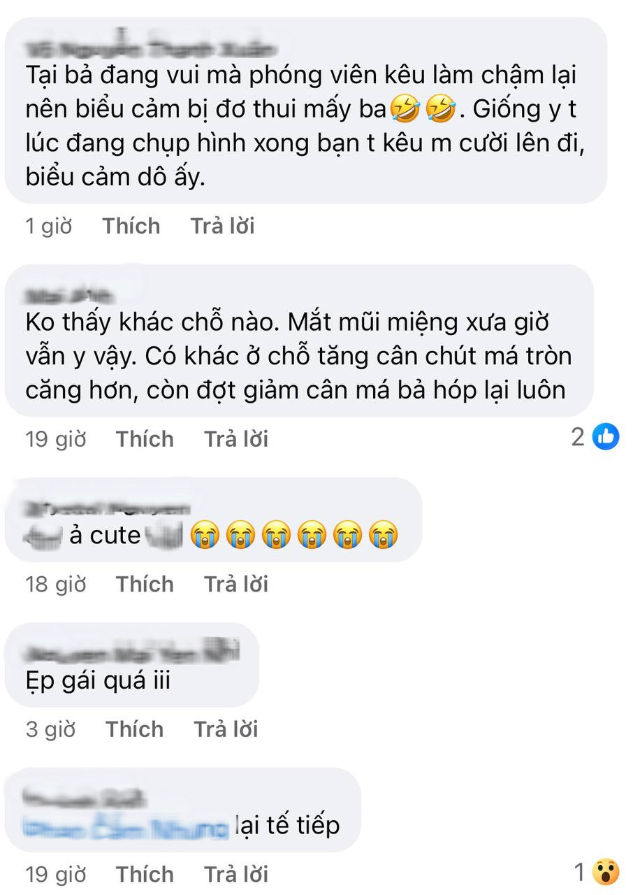 Cũng tới ngày Kim Ji Won bị soi quá đà: Mặt vậy mà vẫn chê?- Ảnh 3.