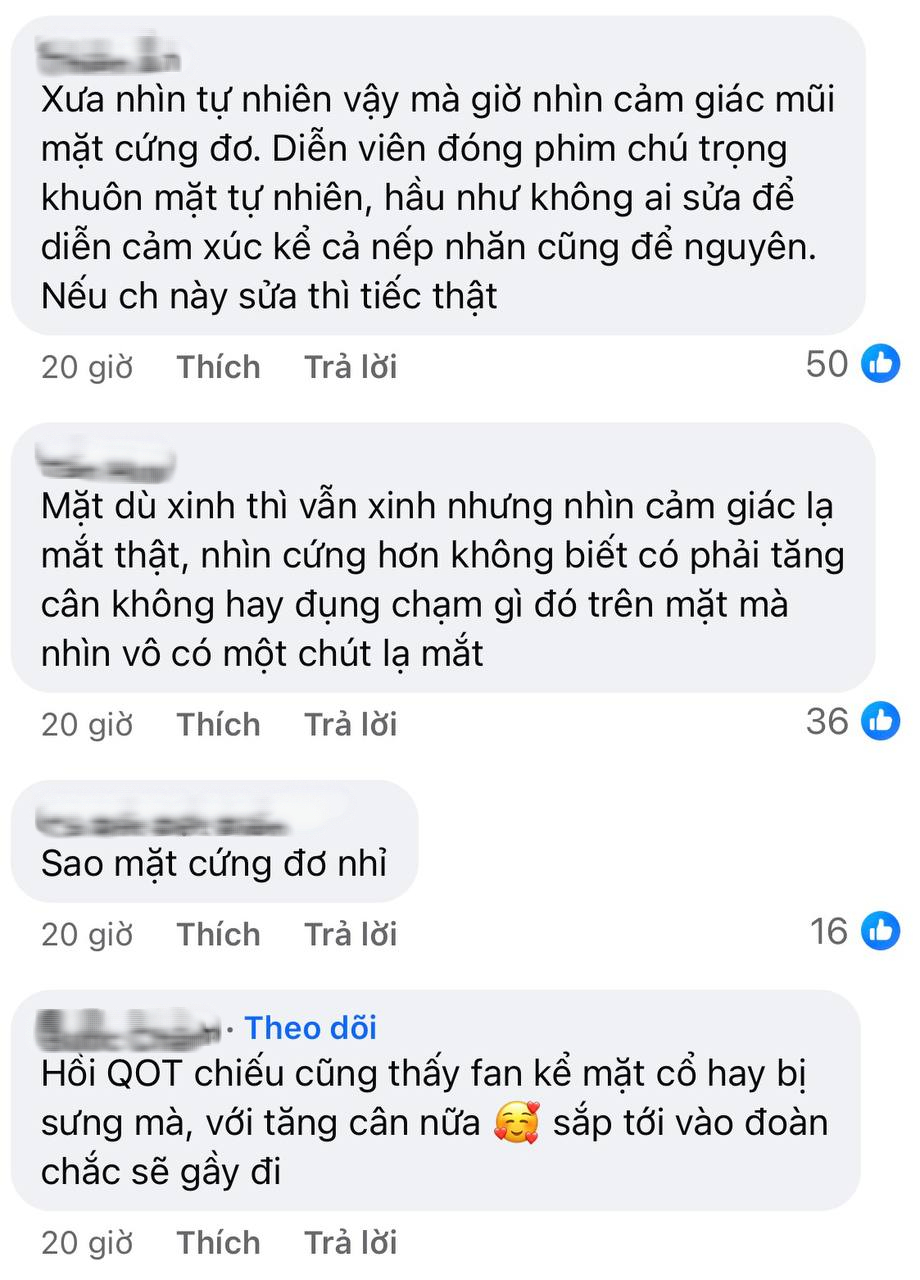 Cũng tới ngày Kim Ji Won bị soi quá đà: Mặt vậy mà vẫn chê?- Ảnh 2.