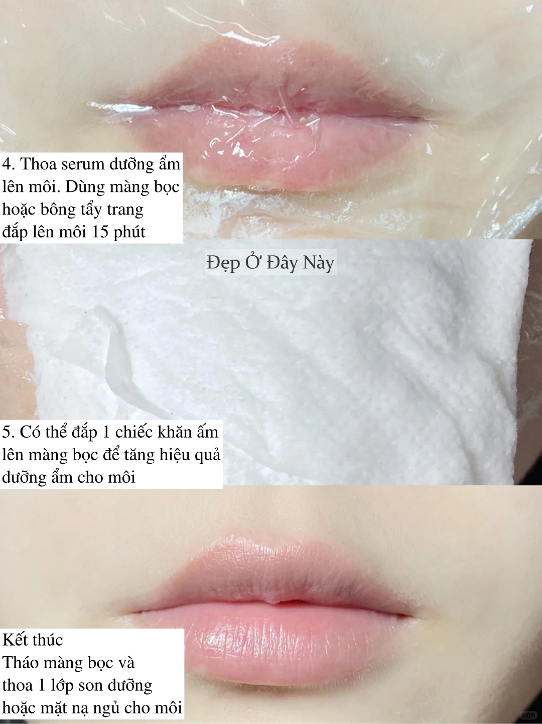 Chuyên viên thẩm mỹ viện 10 năm mách mẹo trị môi khô tại nhà, rẻ mà hiệu quả bất ngờ - Ảnh 4.