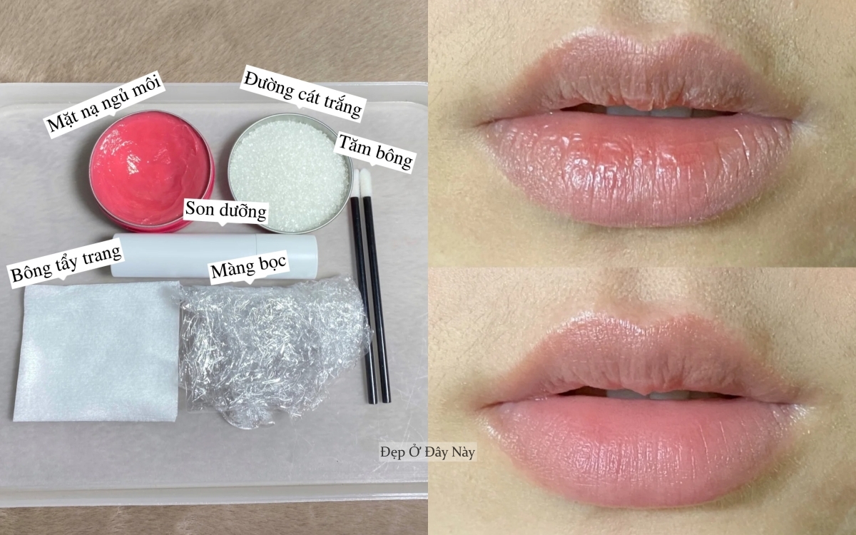 Chuyên viên thẩm mỹ viện 10 năm mách mẹo trị môi khô tại nhà, rẻ mà hiệu quả bất ngờ - Ảnh 2.