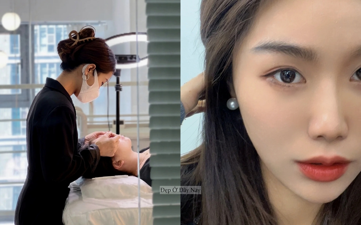 Chuyên viên thẩm mỹ viện 10 năm mách mẹo trị môi khô tại nhà, rẻ mà hiệu quả bất ngờ - Ảnh 5.