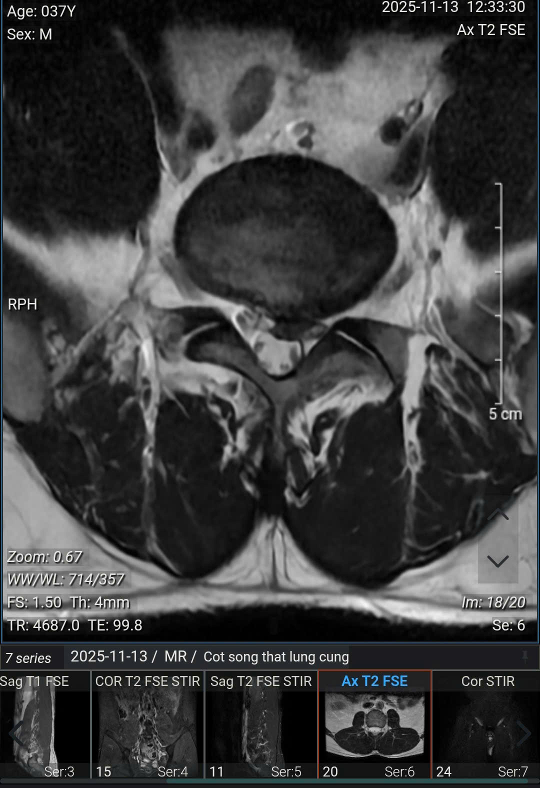 Người đàn ông 37 tuổi ở Hà Nội 