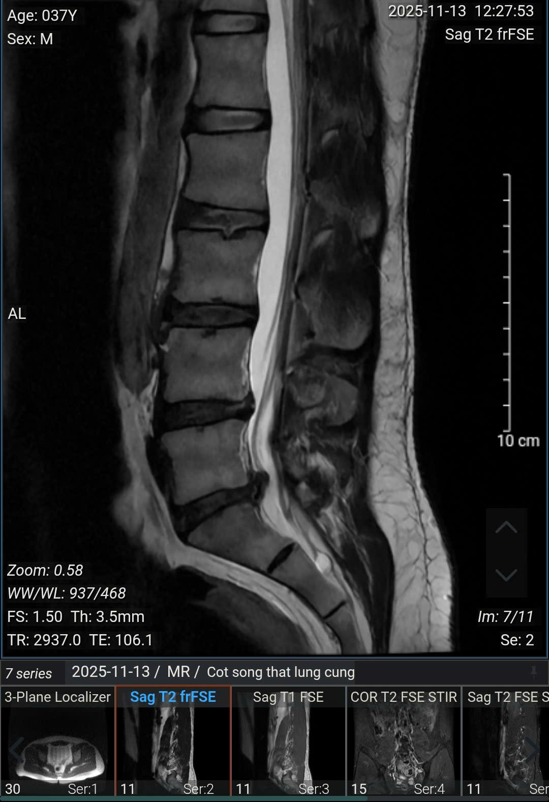 Người đàn ông 37 tuổi ở Hà Nội 