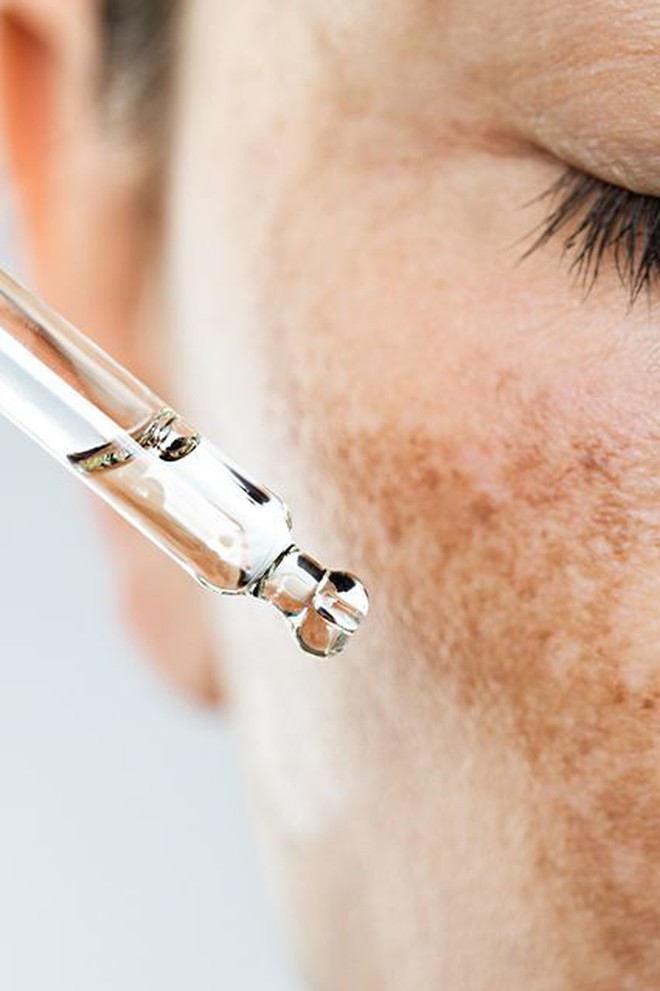 Kem trị nám trôi nổi đang phá hủy da nhiều người mua “nhẹ dạ”- Ảnh 3.