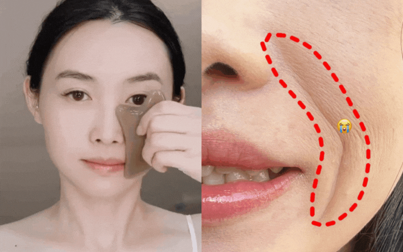 30 ngày xóa nếp nhăn không cần spa với cách nâng cơ, làm mờ rãnh cười của nàng blogger - Ảnh 1.