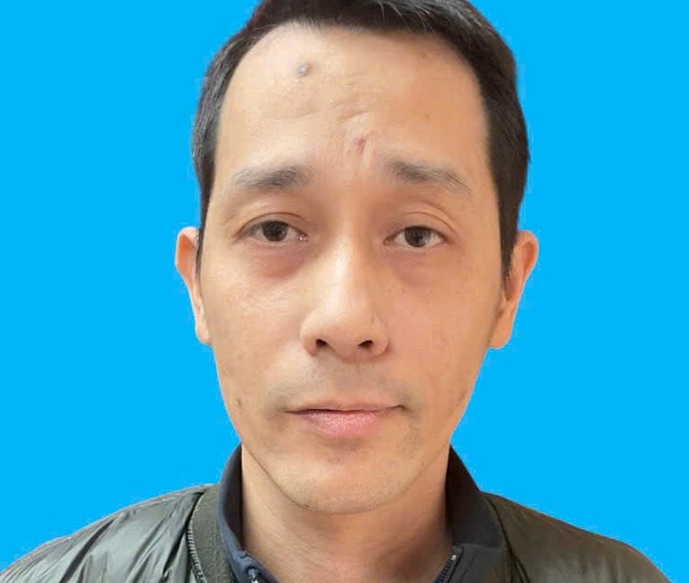 Em chồng dùng dao đâm trọng thương chị dâu tại Hải Phòng - Ảnh 1.