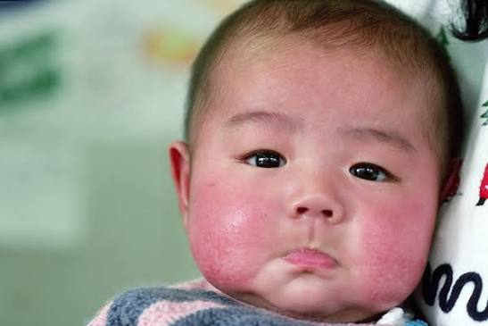 Miên Bắc vào mùa hanh khô, mẹ cần chăm sóc làn da mỏng manh của em bé nhà mình thế nào?- Ảnh 4.