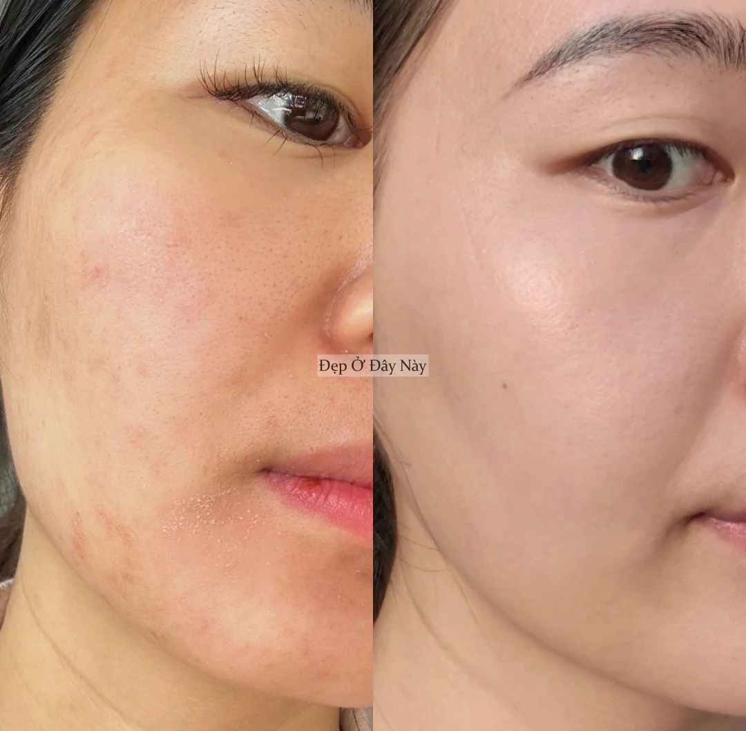 Bác sĩ da liễu không bán sản phẩm - chỉ đưa chu trình, và da tôi đẹp lên thật! - Ảnh 4.