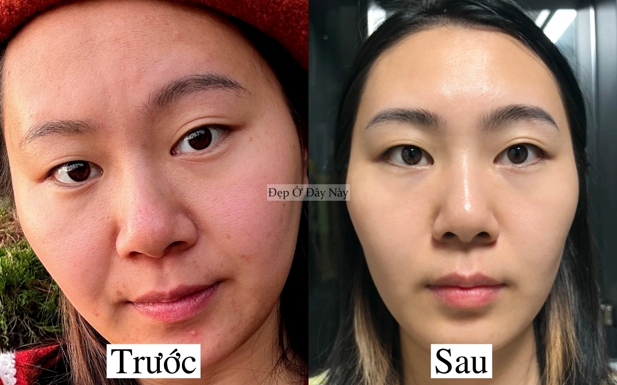 Bác sĩ da liễu không bán sản phẩm - chỉ đưa chu trình, và da tôi đẹp lên thật! - Ảnh 2.