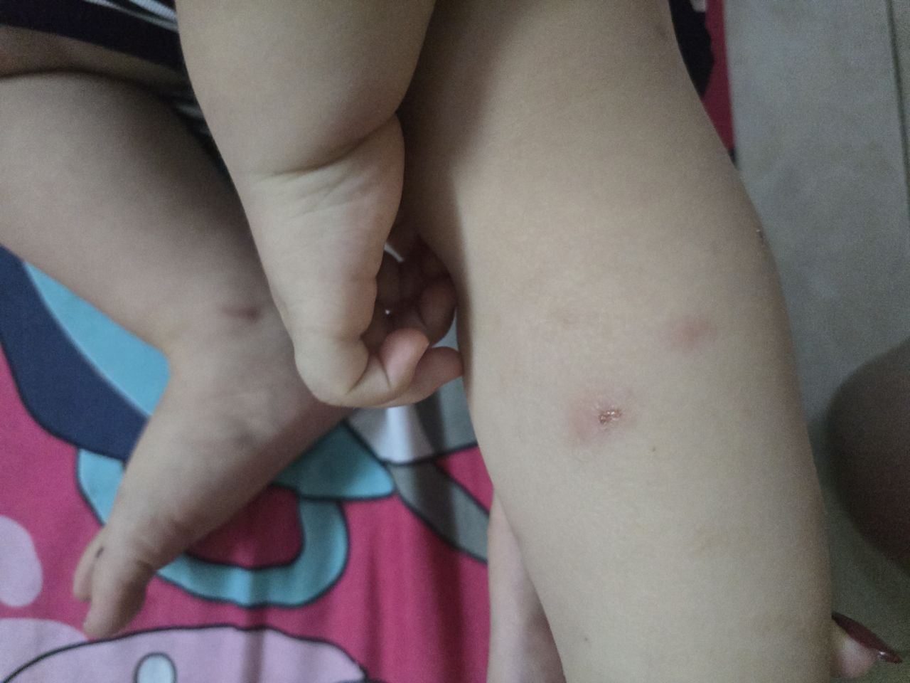 Check tã quần Bobby Antimos: Xoa dịu nỗi bất an của mẹ bỉm có con không đáp ứng thuốc hạ sốt Paracetamol- Ảnh 2.