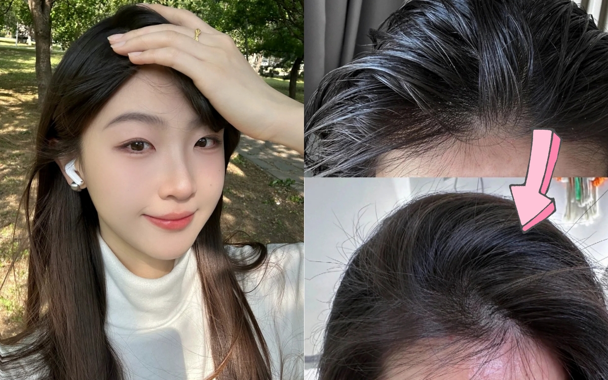 Mùa mưa tóc bết, da đầu ngứa? 5 mẹo cực hay giúp tóc sạch bồng bềnh cả ngày! - Ảnh 1.