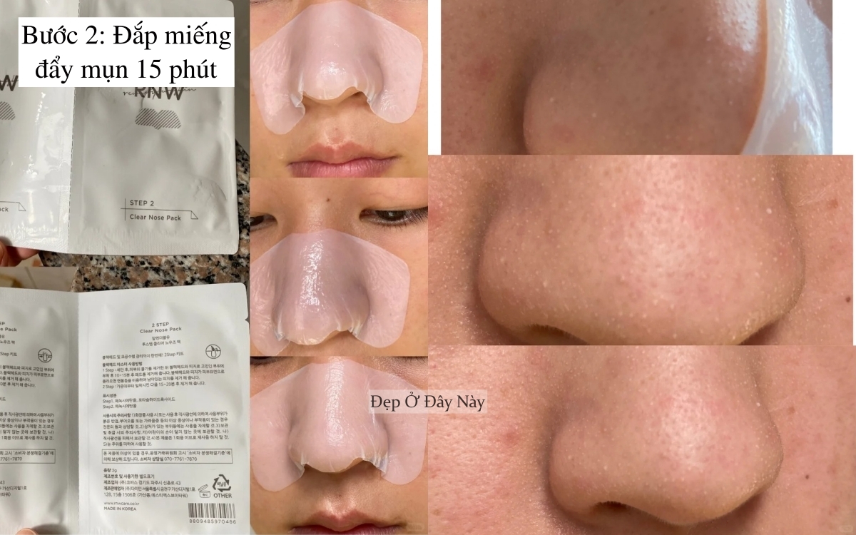 "Tạm biệt mũi dâu tây": Nàng blogger tiết lộ 3 bước giúp da mũi mịn như gương - Ảnh 3. "Tạm biệt mũi dâu tây": Nàng blogger tiết lộ 3 bước giúp da mũi mịn như gương - Ảnh 3.