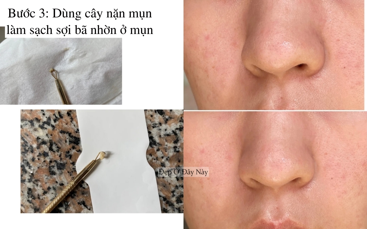 "Tạm biệt mũi dâu tây": Nàng blogger tiết lộ 3 bước giúp da mũi mịn như gương - Ảnh 4. "Tạm biệt mũi dâu tây": Nàng blogger tiết lộ 3 bước giúp da mũi mịn như gương - Ảnh 4.