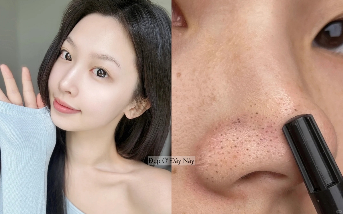 "Tạm biệt mũi dâu tây": Nàng blogger tiết lộ 3 bước giúp da mũi mịn như gương - Ảnh 1. "Tạm biệt mũi dâu tây": Nàng blogger tiết lộ 3 bước giúp da mũi mịn như gương - Ảnh 1.