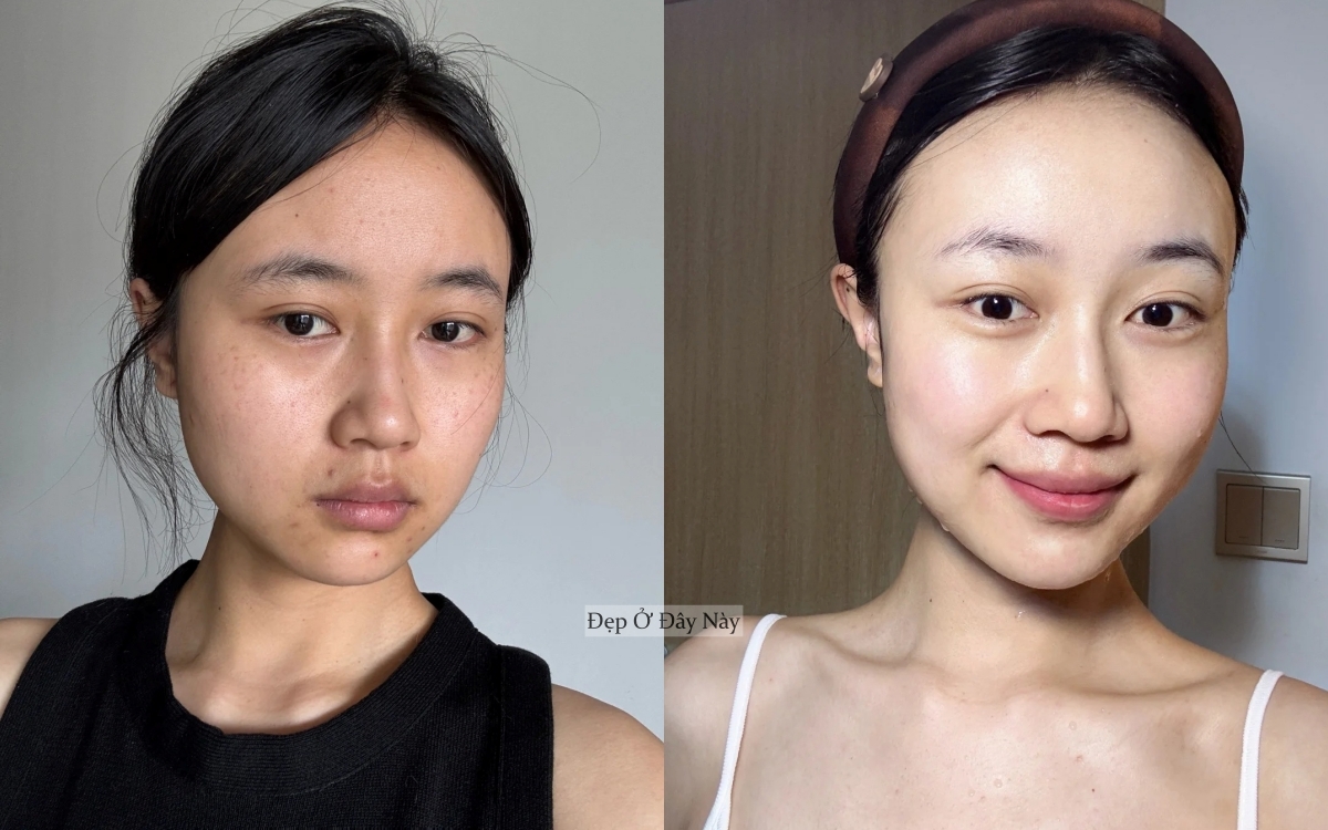 Tôi không skincare cầu kỳ, chỉ ngủ sớm và dưỡng dầu là làn da đã lột xác ngoạn mục!- Ảnh 1.
