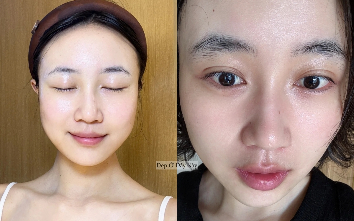 Tôi không skincare cầu kỳ, chỉ ngủ sớm và dưỡng dầu là làn da đã lột xác ngoạn mục!- Ảnh 2.