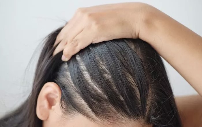 Nhiều chị em da khô, thiếu ngủ, tóc rụng cả nắm vì 1 sai lầm kinh điển khi ăn tập gym- Ảnh 3. Nhiều chị em da khô, thiếu ngủ, tóc rụng cả nắm vì 1 sai lầm kinh điển khi ăn tập gym- Ảnh 3.