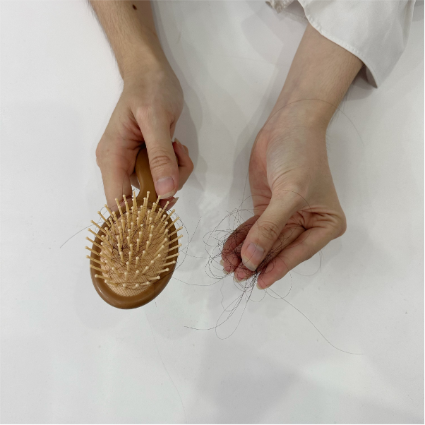 3 thói quen tưởng tốt nhưng lại khiến tóc dễ bị gàu, yếu và tóc gãy rụng - Ảnh 1. 3 thói quen tưởng tốt nhưng lại khiến tóc dễ bị gàu, yếu và tóc gãy rụng - Ảnh 1.