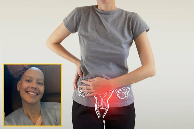 Cuộc chiến sống còn của người phụ nữ 50 tuổi sau khi phẫu thuật loại bỏ 7 cơ quan vì ung thư buồng trứng giai đoạn 4- Ảnh 1.