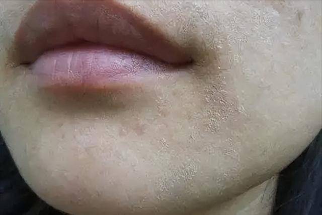 Các bác sĩ đã phát hiện ra rằng những người uống nhiều nước sau khi thức dậy có thể trải qua 6 thay đổi này trong cơ thể chỉ trong vòng 3 tháng! - Ảnh 5.