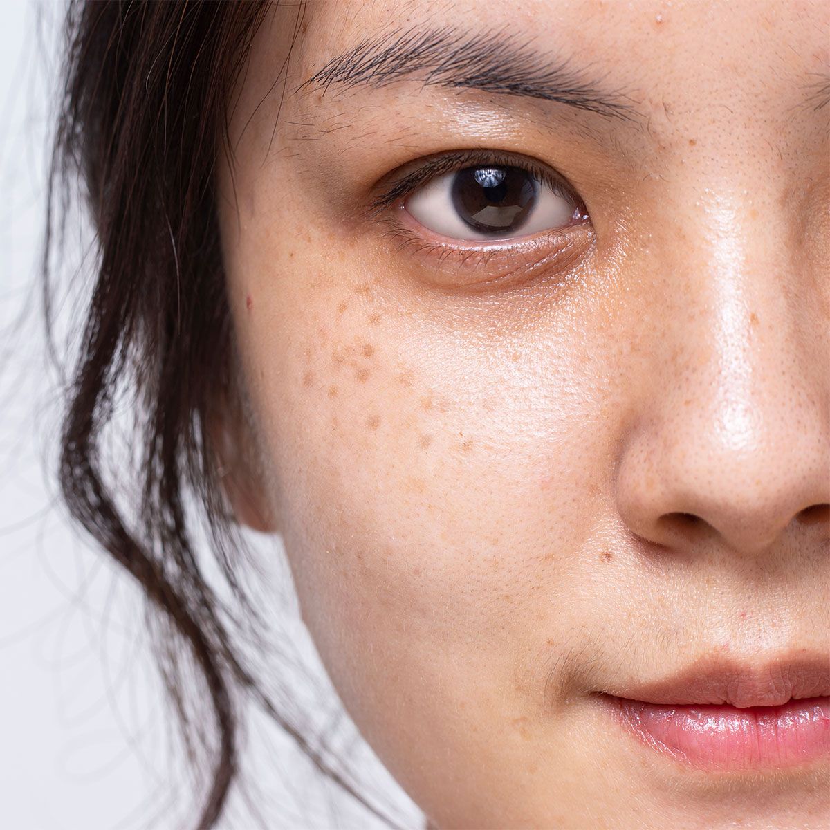 Trị nám tuổi 40 không hề khó nếu bạn bổ sung 2 dưỡng chất này mỗi ngày, phụ nữ trung niên càng nên áp dụng - Ảnh 1. Trị nám tuổi 40 không hề khó nếu bạn bổ sung 2 dưỡng chất này mỗi ngày, phụ nữ trung niên càng nên áp dụng - Ảnh 1.